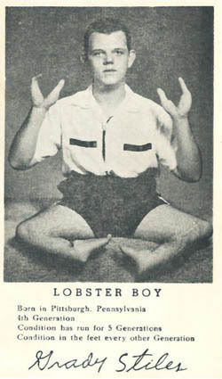 lobster boy presentment